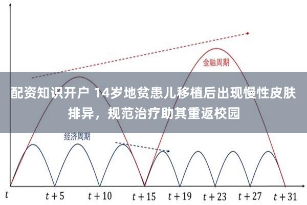 配资知识开户 14岁地贫患儿移植后出现慢性皮肤排异，规范治疗助其重返校园